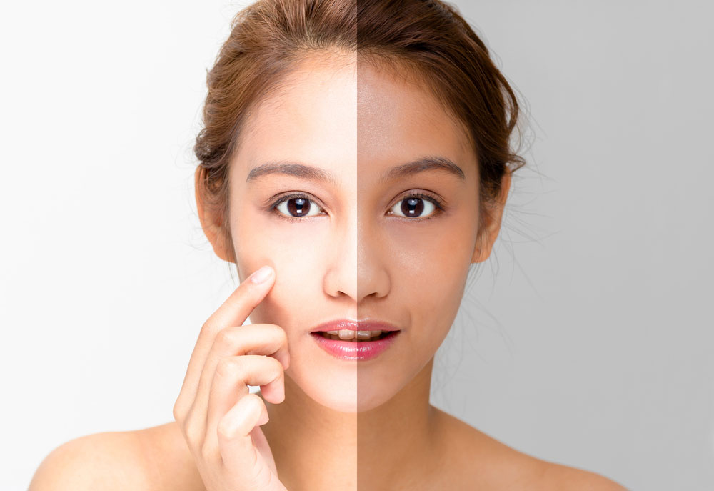Kojic Dipalmitate vs. Kojic Acid: What are the differences?